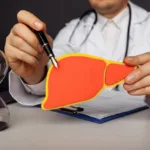 Fatty Liver Disease Treatment in Dhaka – A Complete Patient Guide