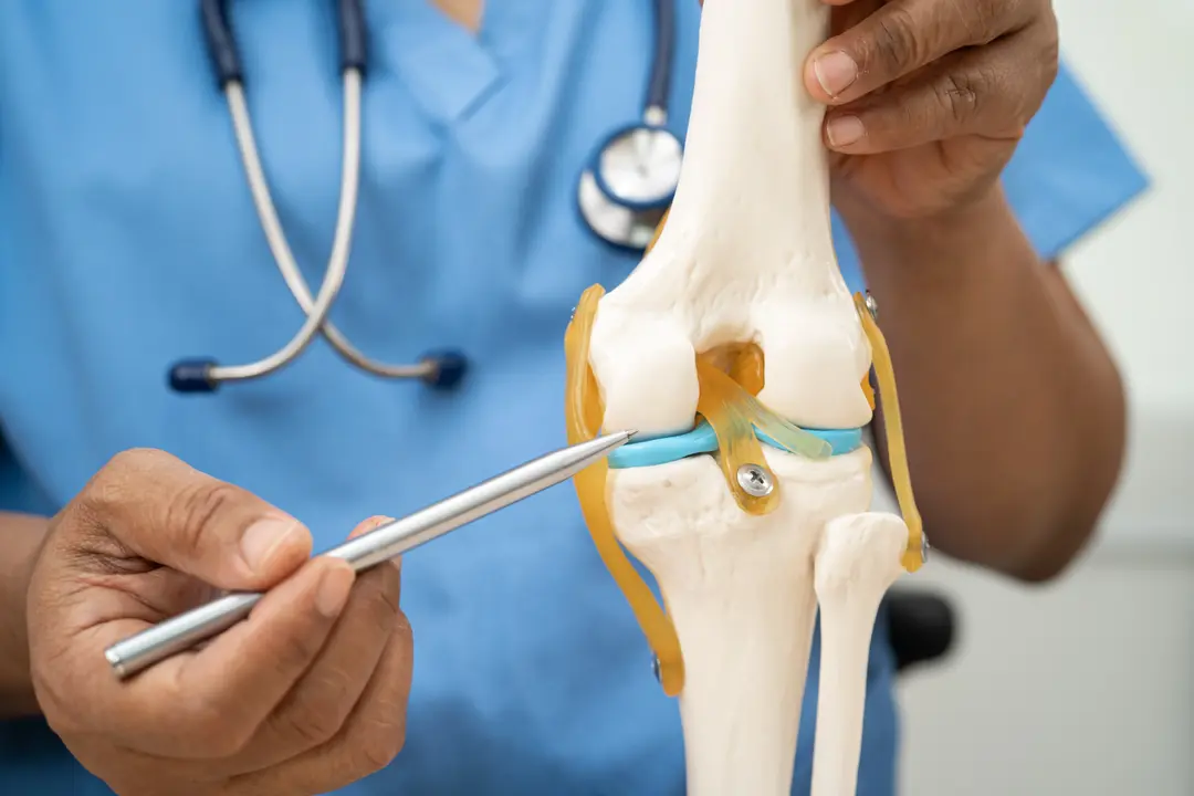 Osteoarthritis Surgeon